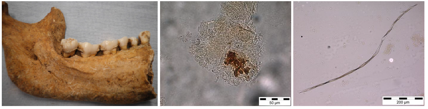 Figura 6. Anàlisi de les fibres trobades dins de matrius de càlcul dental (modificat d'Hendy/Charlton/Radini 2013).